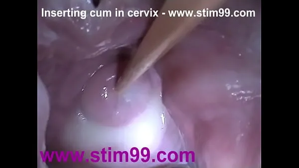 Show Insertion Semen Cum in Cervix Wide Stretching Pussy Speculum drive Clips