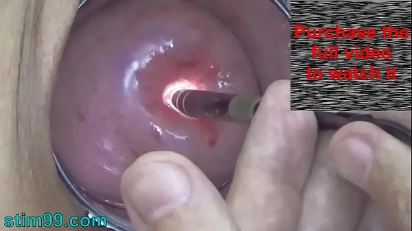 Mostrar Endoscope Camera inside Cervix Cam into Pussy Uterus Clipes de unidade