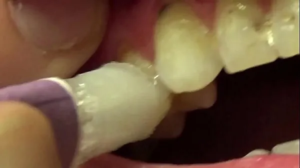 Show Applying Whitening Paste To Her Filthy Teeth drive Clips